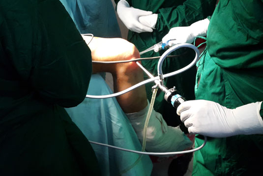 Arthoplastyc & Arthoscopy